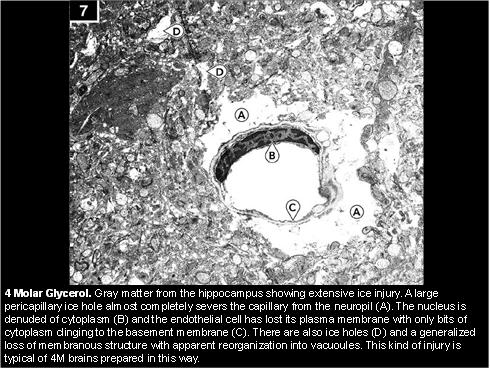 ice damage to cerebral cortex with low molarity glycerol cryoprotection